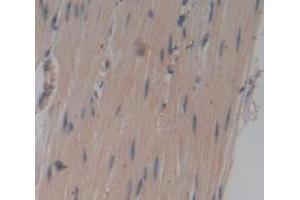 IHC-P analysis of Human Tissue, with DAB staining. (TNNT1 anticorps  (AA 1-259))