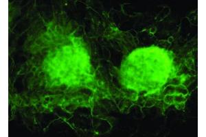 Image no. 3 for anti-Vezatin, Adherens Junctions Transmembrane Protein (VEZT) antibody (ABIN347059) (VEZT anticorps)