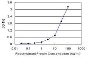 SPP1 (Human) Matched Antibody Pair