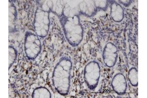 Immunoperoxidase of monoclonal antibody to NME6 on formalin-fixed paraffin-embedded human small Intestine.