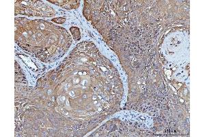 IHC analysis of YWHAE using anti-YWHAE antibody (ABIN7599165). (YWHAE anticorps  (AA 1-255))
