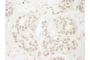 anti-Protein Phosphatase 3, Catalytic Subunit, alpha Isoform (PPP3CA) (C-Term) antibody