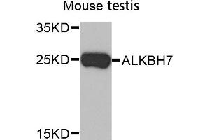 Western Blotting (WB) image for anti-AlkB, Alkylation Repair Homolog 7 (ALKBH7) antibody (ABIN2650897) (ALKBH7 anticorps)