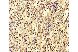 Immunohistochemistry of paraffin-embedded human spleen tissue using ABIN7144155 at dilution of 1:100 (ANKDD1A anticorps  (AA 272-490))