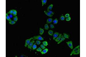 Immunofluorescent analysis of PC-3 cells using ABIN7160177 at dilution of 1:100 and Alexa Fluor 488-congugated AffiniPure Goat Anti-Rabbit IgG(H+L)