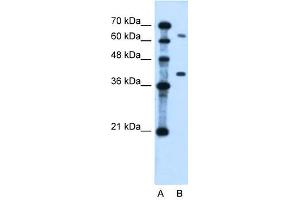 LRRC26 antibody used at 0. (LRRC26 anticorps  (Middle Region))