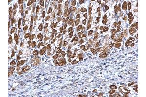 IHC-P Image ETFA antibody detects ETFA protein at mitochondria on mouse heart by immunohistochemical analysis. (ETFA anticorps  (Center))
