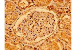 Immunohistochemistry of paraffin-embedded human kidney tissue using ABIN7170894 at dilution of 1:100 (SDHAF1 anticorps  (AA 78-115))