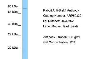 Western Blotting (WB) image for anti-BR Serine/threonine Kinase 1 (BRSK1) (C-Term) antibody (ABIN2788234) (BRSK1 anticorps  (C-Term))