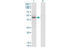 Western Blot analysis of TARBP2 expression in transfected 293T cell line by TARBP2 monoclonal antibody (M04), clone 2G10. (TARBP2 anticorps  (AA 141-250))