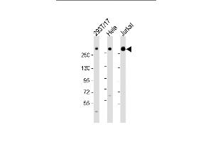 All lanes : Anti-IGF2R Antibody (C-Term) at 1:2000 dilution Lane 1: 293T/17 whole cell lysate Lane 2: Hela whole cell lysate Lane 3: Jurkat whole cell lysate Lysates/proteins at 20 μg per lane. (IGF2R anticorps  (AA 2424-2458))