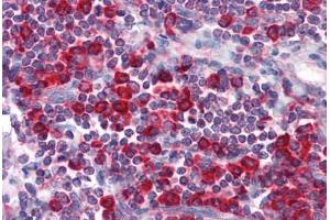 Human Tonsil: Formalin-Fixed, Paraffin-Embedded (FFPE) (MTDH anticorps)