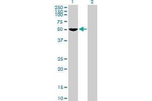 Western Blot analysis of FOXD4 expression in transfected 293T cell line by FOXD4 MaxPab polyclonal antibody. (FOXD4 anticorps  (AA 1-439))
