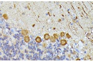 Immunohistochemistry of paraffin-embedded Mouse cerebellum using ELP3 Polyclonal Antibody at dilution of 1:100 (40x lens).