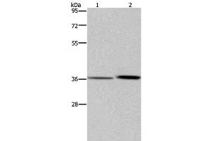 Western Blot analysis of A549 cell and Human fetal liver tissue using MAGEF1 Polyclonal Antibody at dilution of 1:300 (MAGEF1 anticorps)