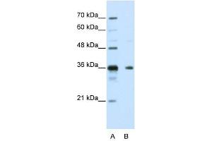NANOS1 antibody used at 5 ug/ml to detect target protein. (Nanos Homolog 1 anticorps)