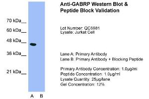 Host:  Rabbit  Target Name:  GABRP  Sample Type:  Jurkat  Lane A:  Primary Antibody  Lane B:  Primary Antibody + Blocking Peptide  Primary Antibody Concentration:  1. (GABRP anticorps  (N-Term))