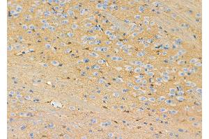ABIN6263073 and ABIN6272517 at 1/100 staining Rat brain tissue by IHC-P. (MAGEE2 anticorps  (Internal Region))