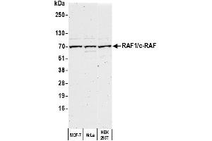 Western Blotting (WB) image for anti-V-Raf-1 Murine Leukemia Viral Oncogene Homolog 1 (RAF1) (AA 598-648) antibody (ABIN7451996)