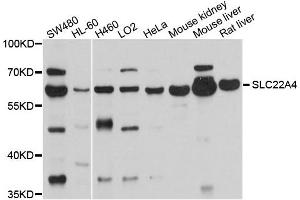 Western blot analysis of extracts of various cells, using SLC22A4 antibody. (SLC22A4 anticorps)