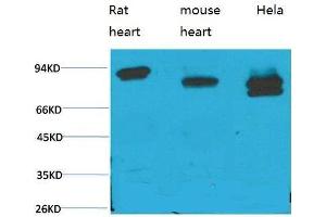 Western Blot (WB) analysis of 1) Rat Heart Tissue, 2)Mouse Heart Tissue, 3) HeLa with STAT3 Mouse Monoclonal Antibody diluted at 1:2000. (STAT3 anticorps)