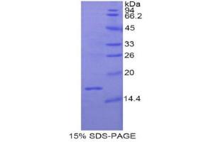 SDS-PAGE (SDS) image for Relaxin 3 (RLN3) (AA 1-140) protein (His tag) (ABIN2121991)