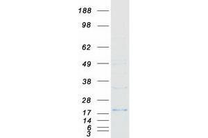 Validation with Western Blot