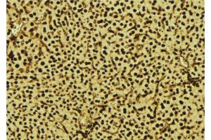 ABIN6277573 at 1/100 staining Mouse liver tissue by IHC-P.