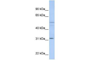 WB Suggested Anti-ZFYVE19 Antibody Titration:  0. (ZFYVE19 anticorps  (C-Term))
