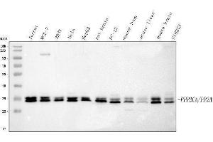 Western blot analysis of PPP2CA using anti-PPP2CA antibody (ABIN3043356). (PPP2CA anticorps  (AA 1-309))