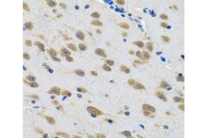 Immunohistochemistry of paraffin-embedded Rat brain using LGR6 Polyclonal Antibody at dilution of 1:100 (40x lens). (LGR6 anticorps)