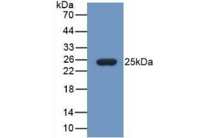 Detection of Recombinant FBLN1, Mouse using Monoclonal Antibody to Fibulin 1 (FBLN1) (Fibulin 1 anticorps  (AA 399-578))