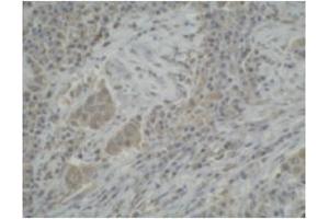 Image no. 1 for anti-Cytochrome P450, Family 3, Subfamily A, Polypeptide 5 (CYP3A5) (C-Term) antibody (ABIN793669)