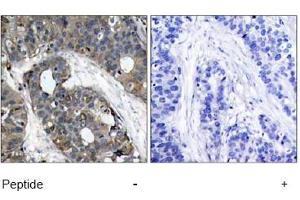 Image no. 1 for anti-Heat Shock 27kDa Protein 1 (HSPB1) (AA 80-84) antibody (ABIN197490) (HSP27 anticorps  (AA 80-84))