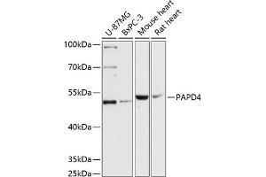 Western blot analysis of extracts of various cell lines, using P antibody (ABIN6132457, ABIN6145211, ABIN6145212 and ABIN6217164) at 1:3000 dilution. (PAPD4 anticorps  (AA 1-300))