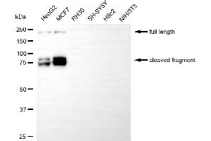 Western blotting analysis using L1 cell adhesion molecule antibody (ABIN7799219). (Recombinant L1CAM anticorps)
