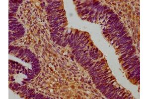 anti-Sushi Domain Containing 5 (SUSD5) (AA 46-287) antibody