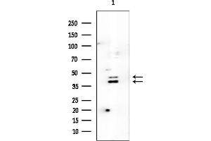 anti-Protein L-Myc (MYCL) antibody