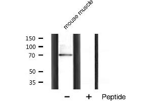 Western blot analysis of p70 S6 Kinase expression in mouse muscle tissue lysates,The lane on the right is treated with the antigen-specific peptide. (RPS6KB1 anticorps  (Internal Region))