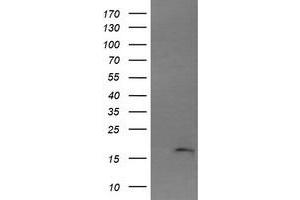 Image no. 1 for anti-Cancer/testis Antigen 1B (CTAG1B) antibody (ABIN1499900) (CTAG1B anticorps)