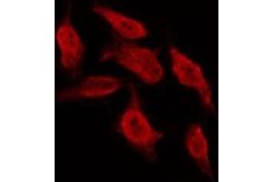 ABIN6267001 staining MCF7 by IF/ICC. (Bcl-2 anticorps  (Internal Region))