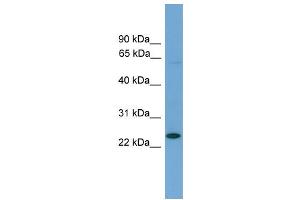 WB Suggested Anti-Ascl3 Antibody Titration: 0. (ASCL3 anticorps  (Middle Region))
