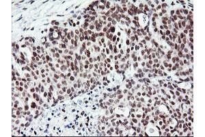 Image no. 2 for anti-Ring Finger Protein 113B (RNF113B) antibody (ABIN1500715) (RNF113B anticorps)