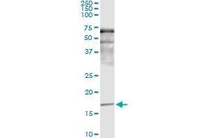 Immunoprecipitation of SNCA transfected lysate using anti-SNCA monoclonal antibody and Protein A Magnetic Bead , and immunoblotted with SNCA MaxPab rabbit polyclonal antibody.