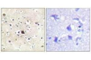 Immunohistochemical analysis of paraffin-embedded human brain tissue using GR (Ab-226) antibody.