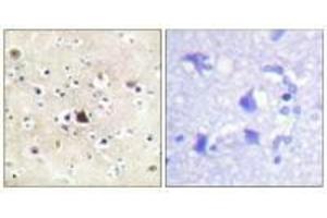 Immunohistochemical analysis of paraffin-embedded human brain tissue using GR (Ab-226) antibody. (Glucocorticoid Receptor anticorps  (Ser226, Ser234, Ser246))