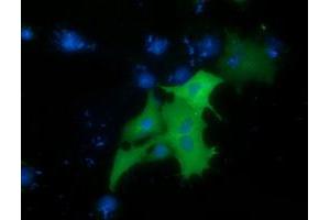 Immunofluorescence (IF) image for anti-Protein Kinase D2 (PKD2) antibody (ABIN1500412) (PKD2 anticorps)
