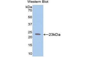 Western Blotting (WB) image for anti-Elastin (ELN) (AA 392-645) antibody (ABIN1858709) (Elastin anticorps  (AA 392-645))