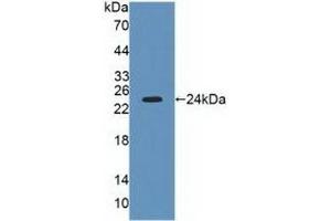 Detection of Recombinant LYPLA2, Human using Polyclonal Antibody to Lysophospholipase II (LYPLA2) (LYPLA2 anticorps  (AA 1-196))
