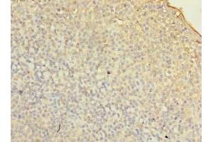 Immunohistochemistry of paraffin-embedded human tonsil tissue using ABIN7153114 at dilution of 1:100 (Formin-Like 1 anticorps  (AA 207-457))